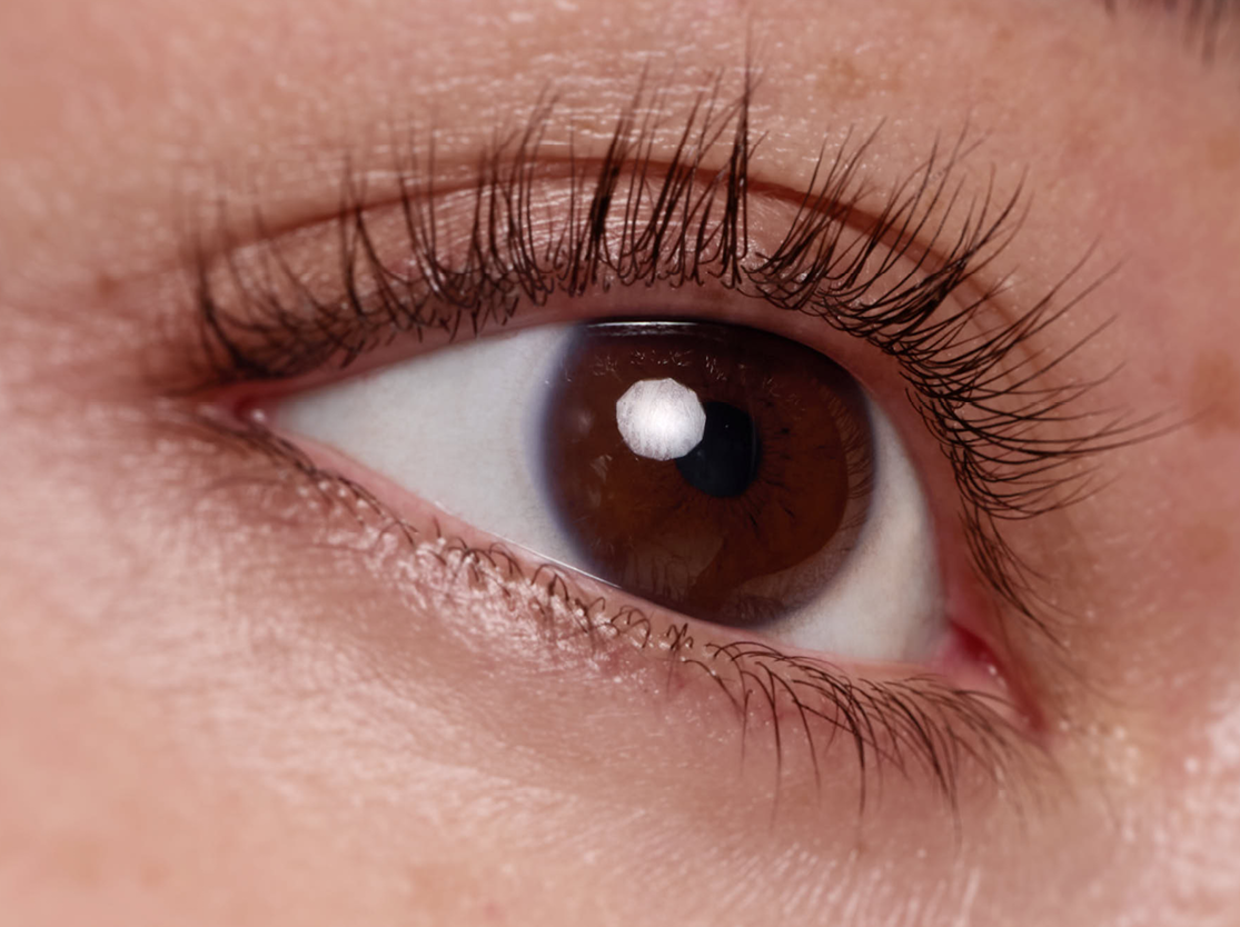 RapidEye® Firming Wrinkle Smoother